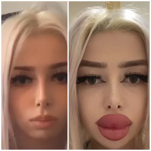 Turned from a 4 to a 10