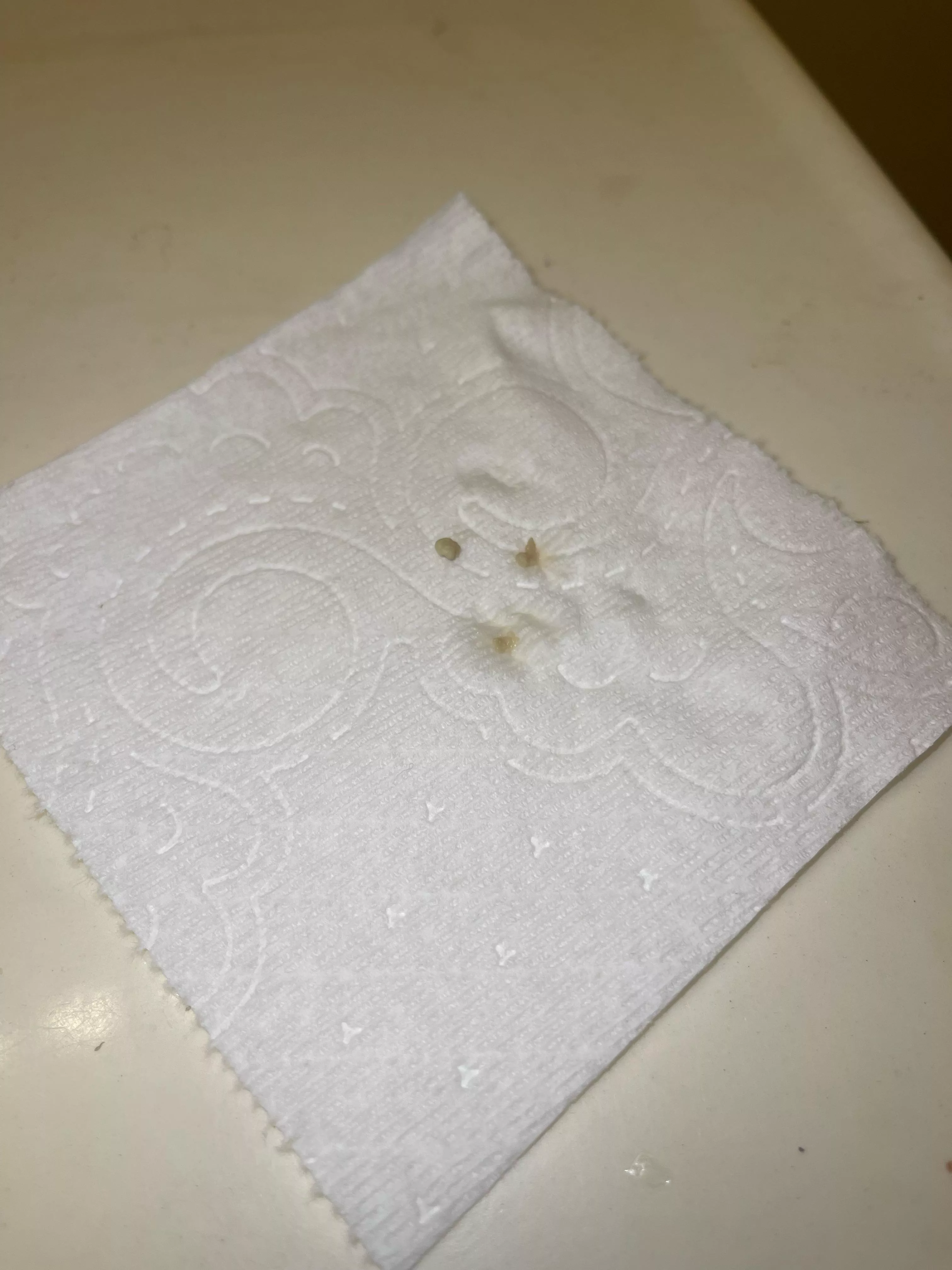 My throat felt weird all day and I had terrible breath when I woke up…wonder why