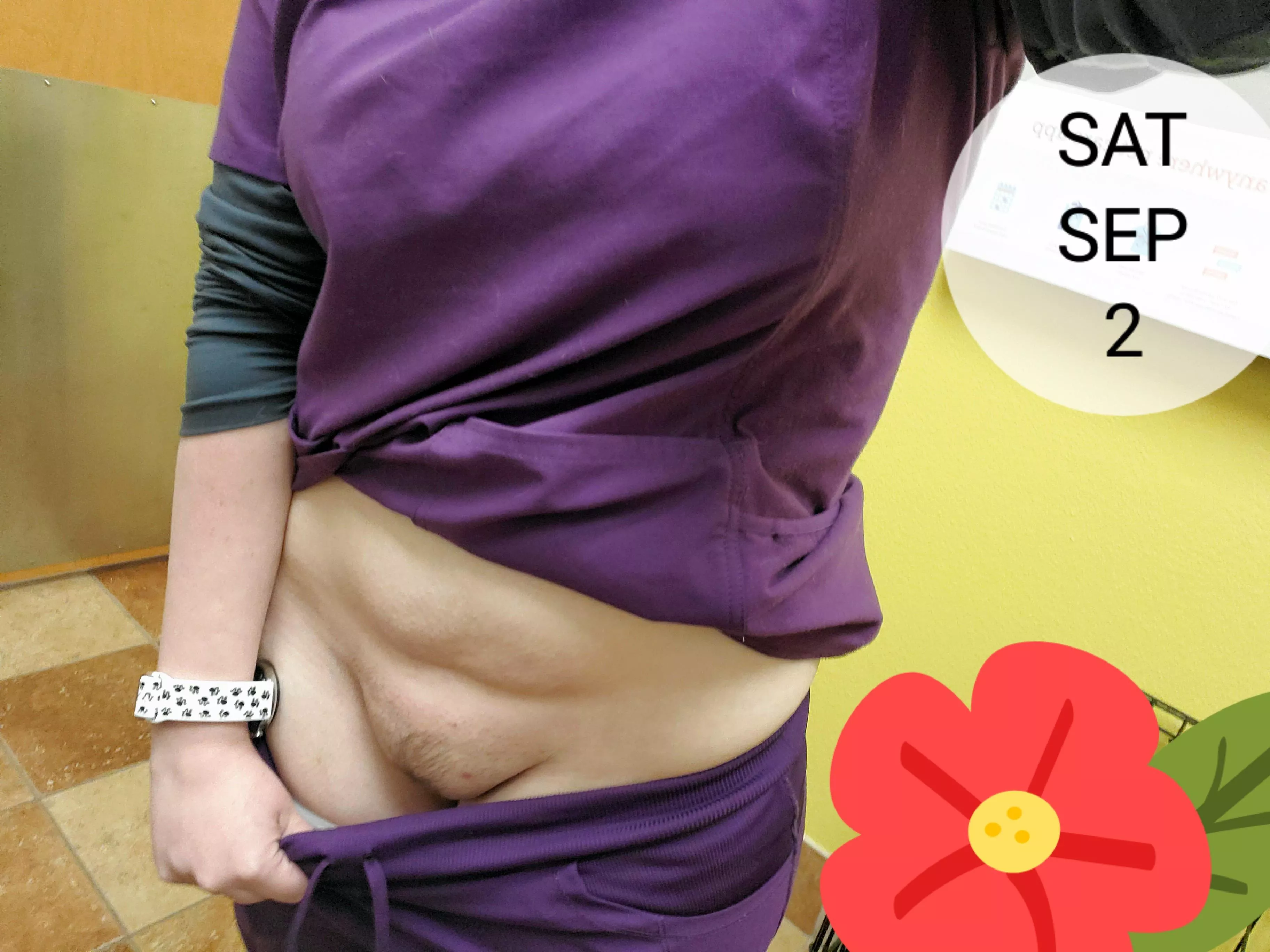 Showing off my mound in my scrubs at work 🥰