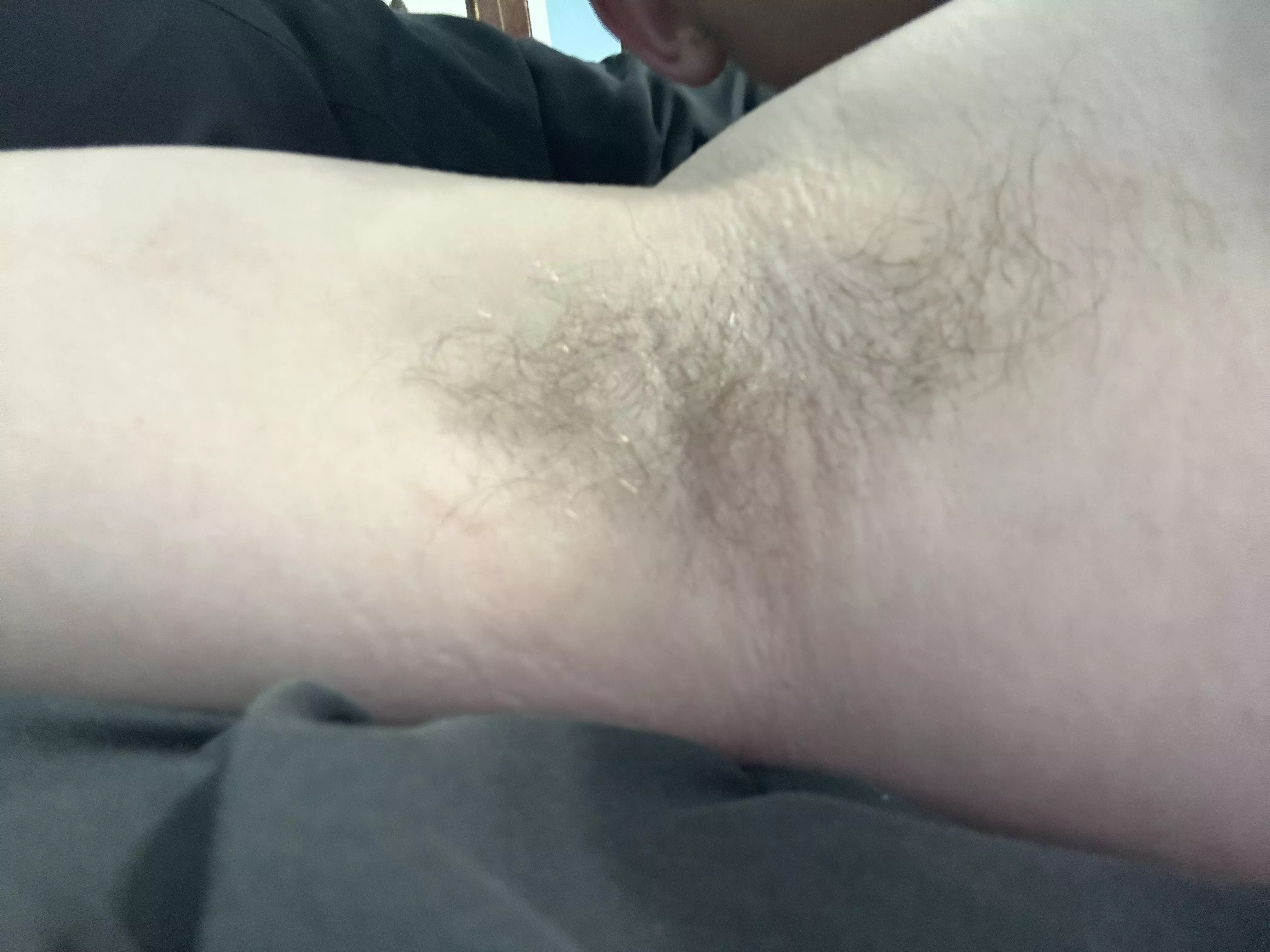 21yo armpit