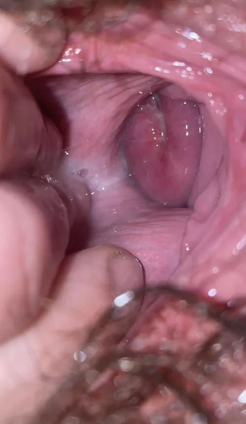 Got a real good picture of my cervix would you lick all the cum up?