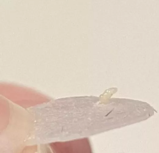 I pulled my pimple patch off and this happened...