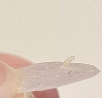 I pulled my pimple patch off and this happened...