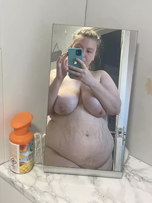 My workmates bullied me and said I was fat. Should I start losing weight?