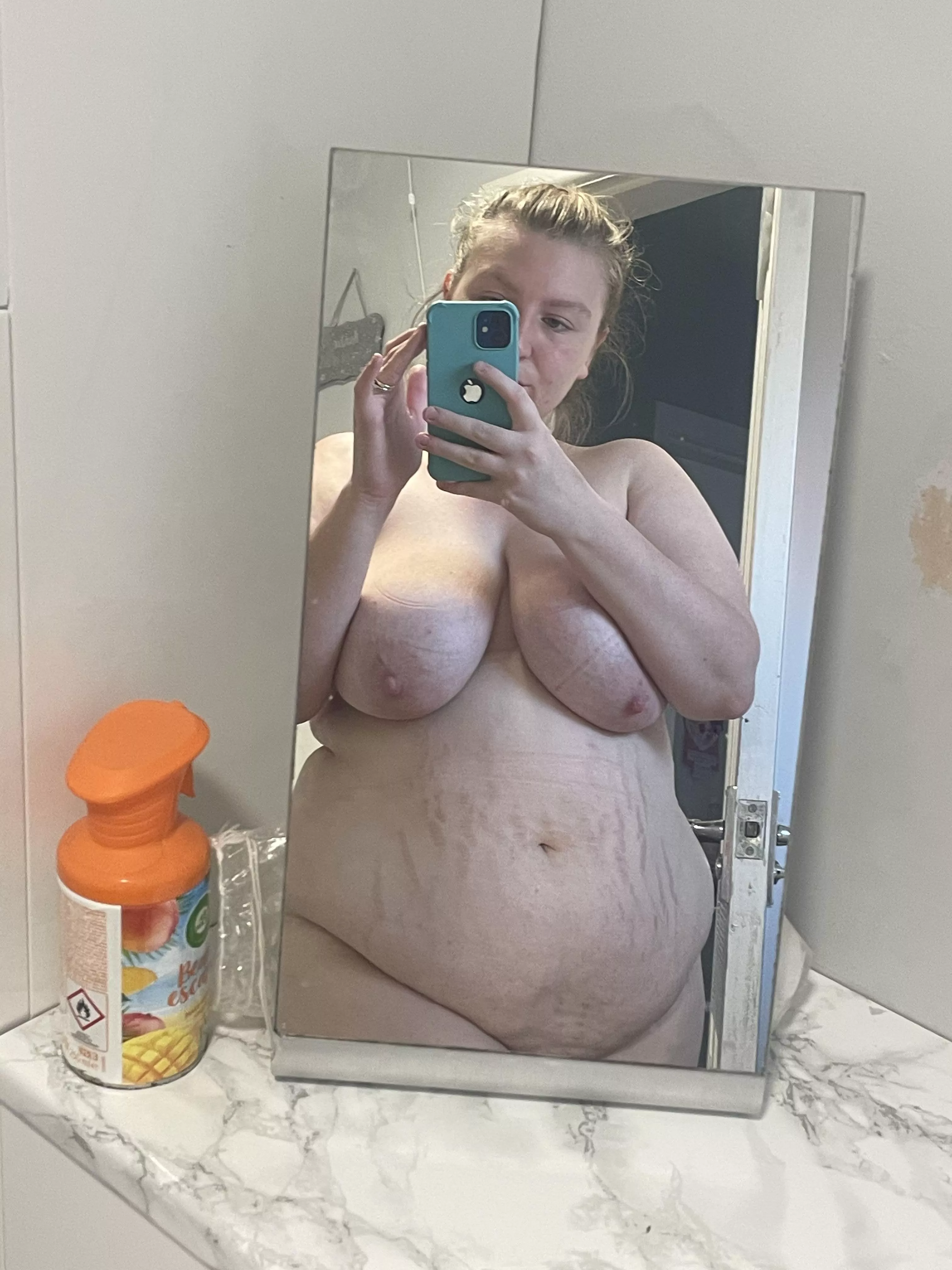 My workmates bullied me and said I was fat. Should I start losing weight?