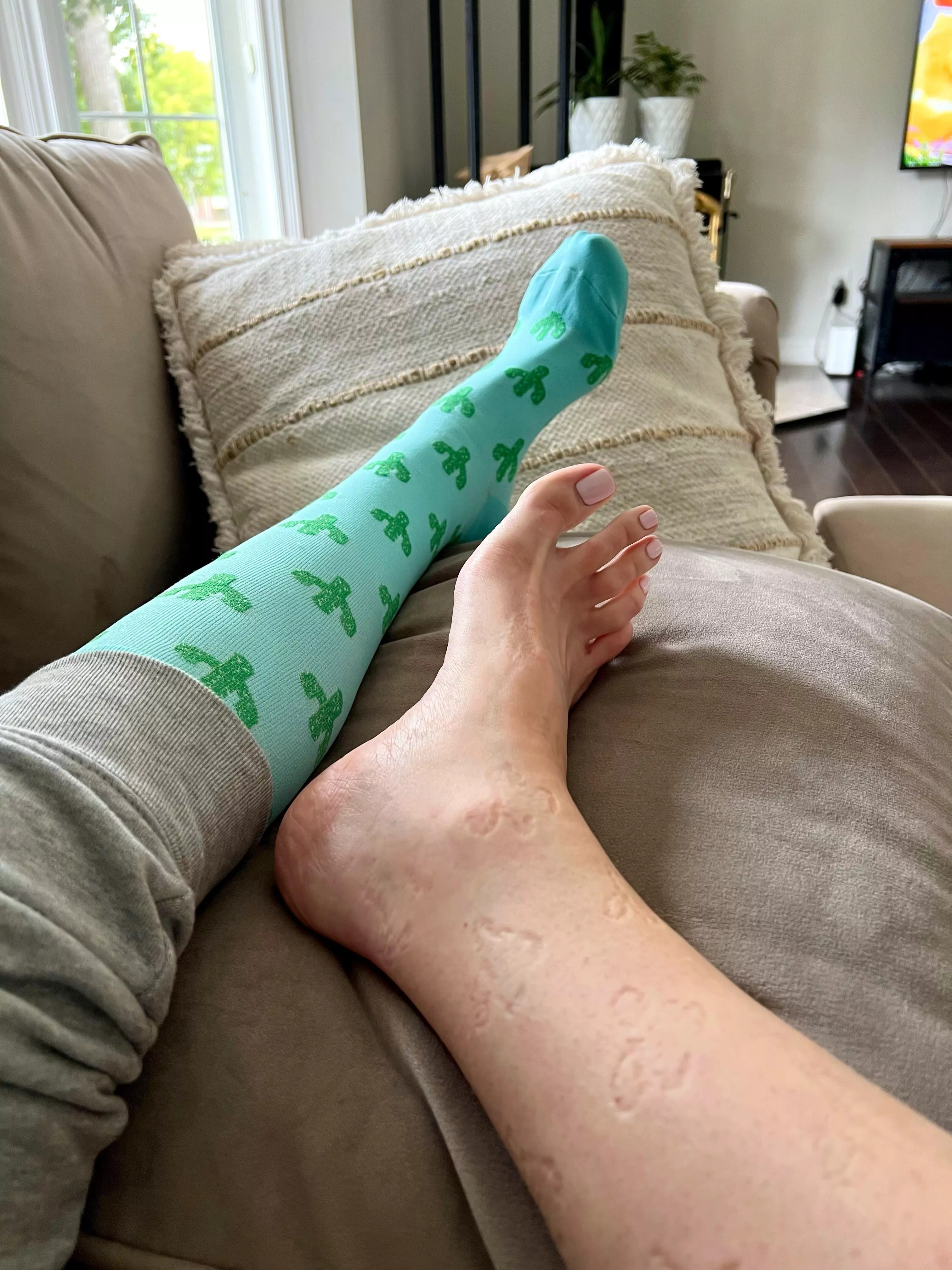 My socks are leaving cactus prints on my legs 🙊 [selling]