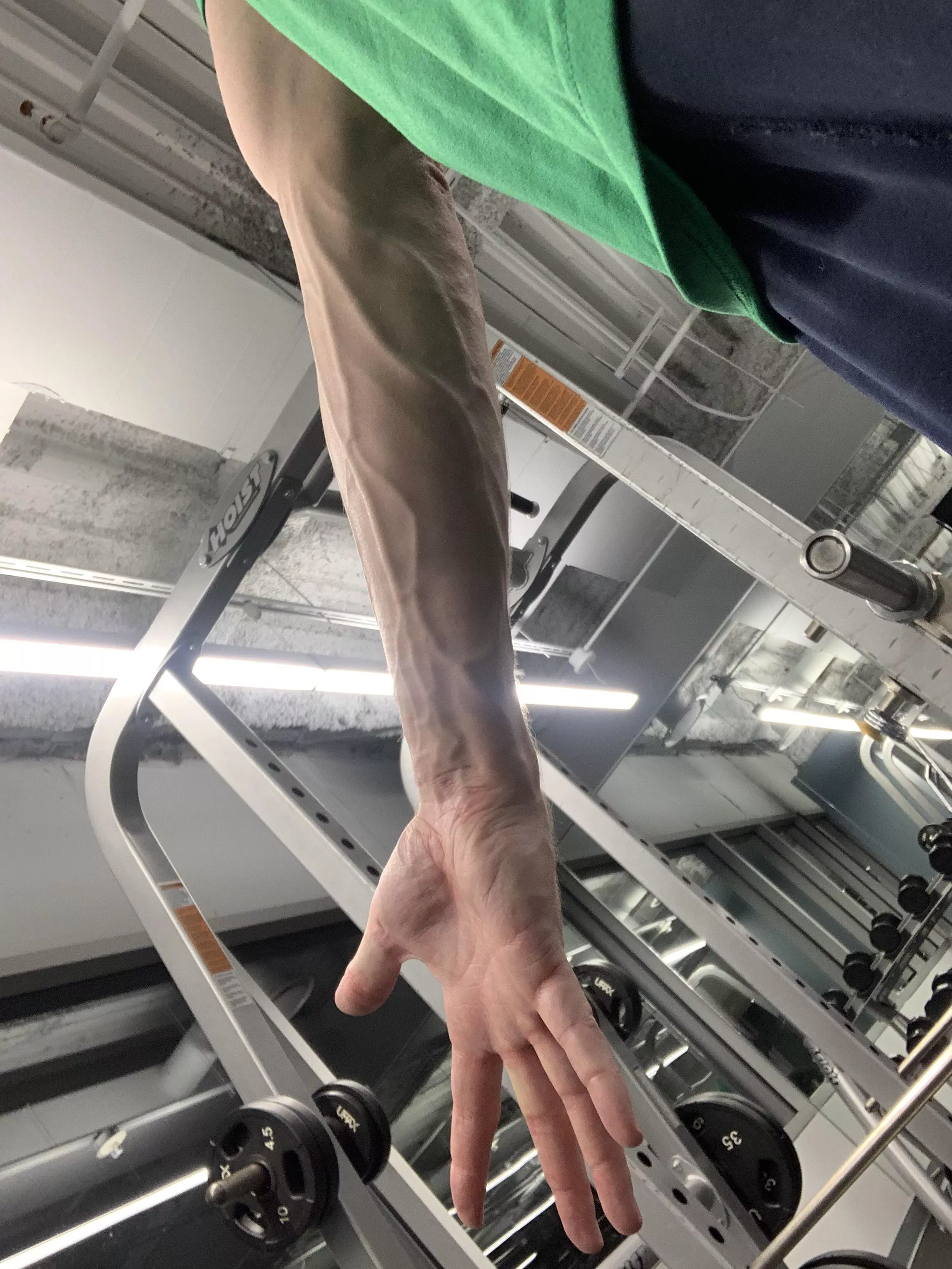 Vascularity
