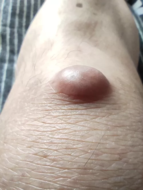 Counting down the days...