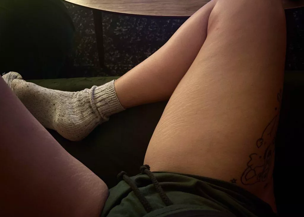 i can’t be the only freak who thinks stretch marks look cool