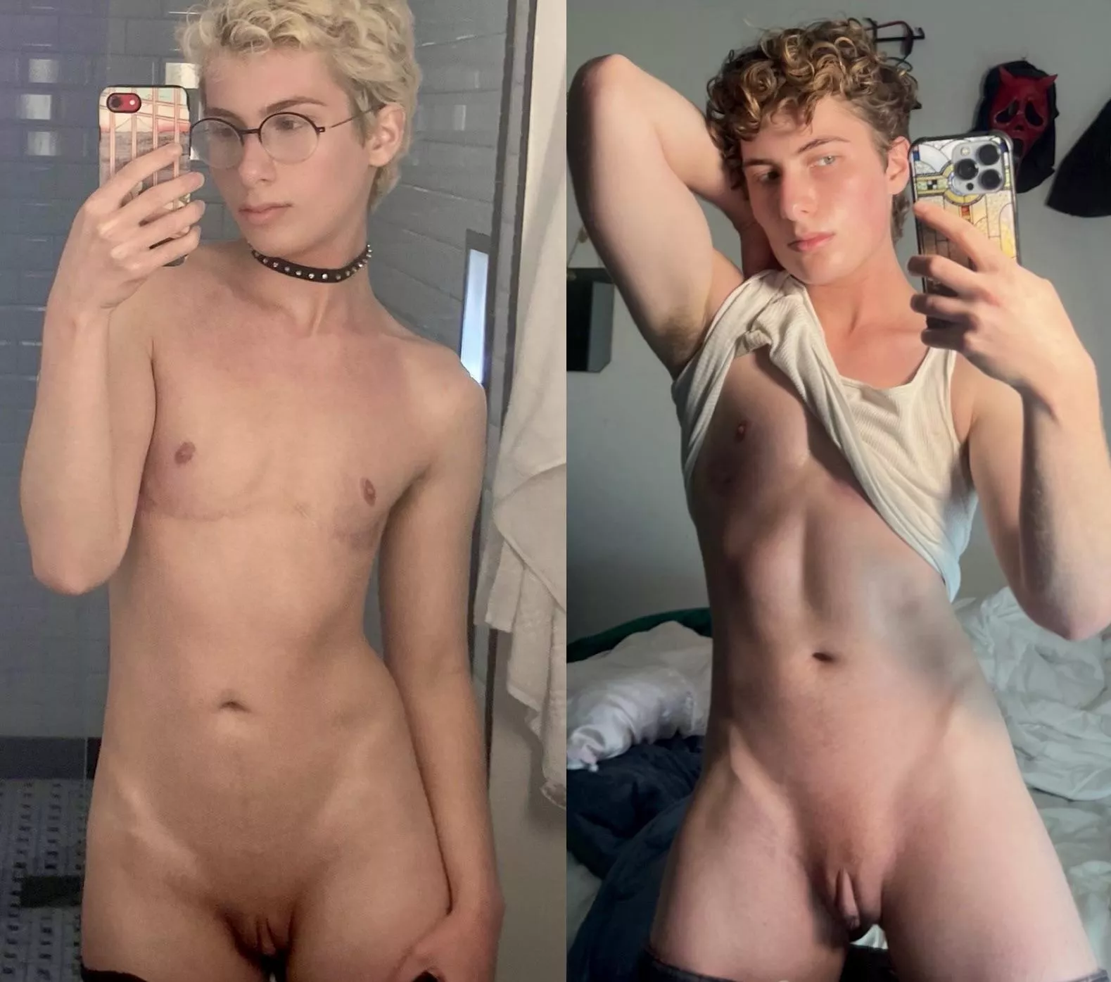 Two to four years on testosterone (FtM)