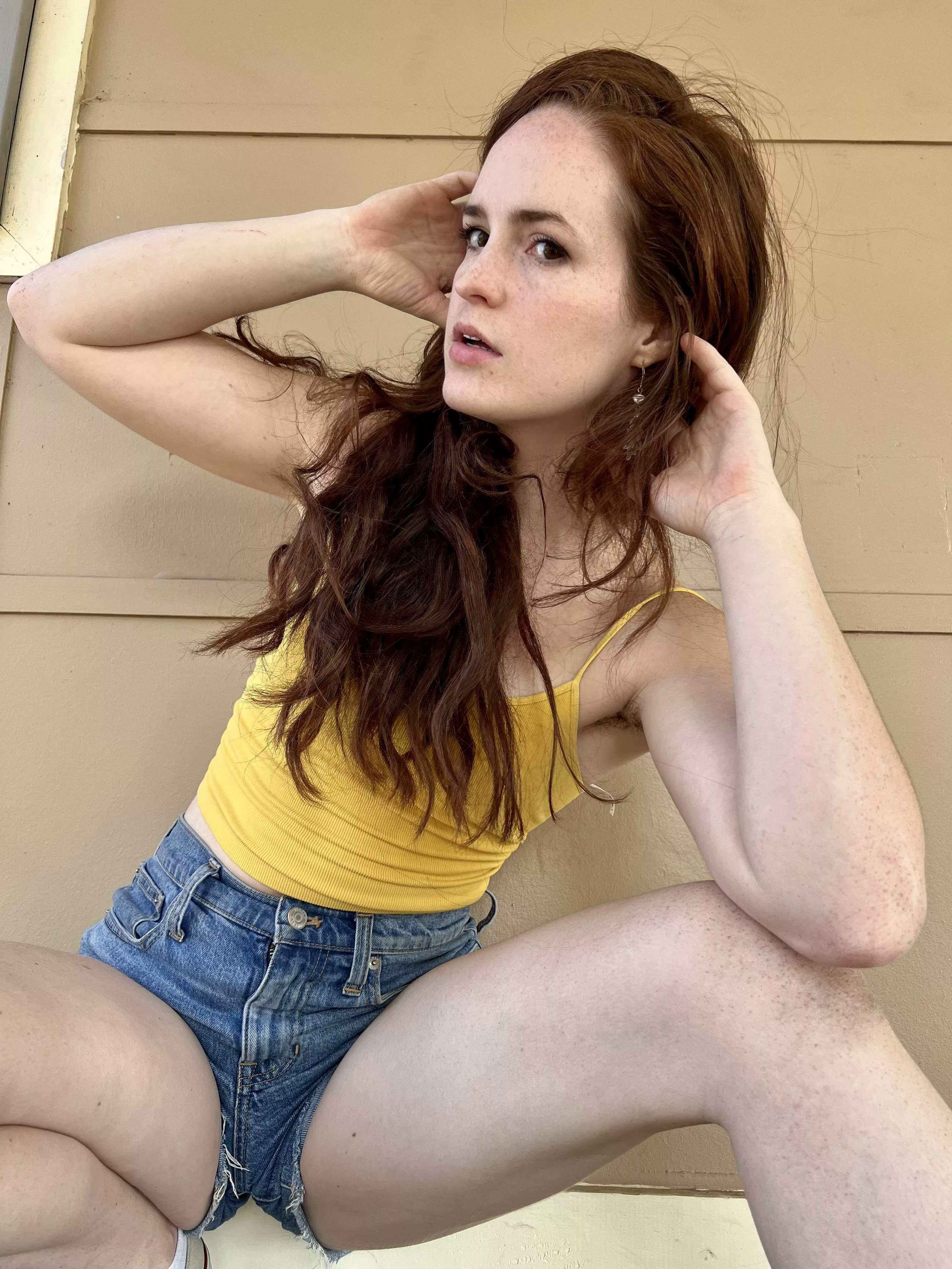 Would you love on my freckly knees and elbows too?