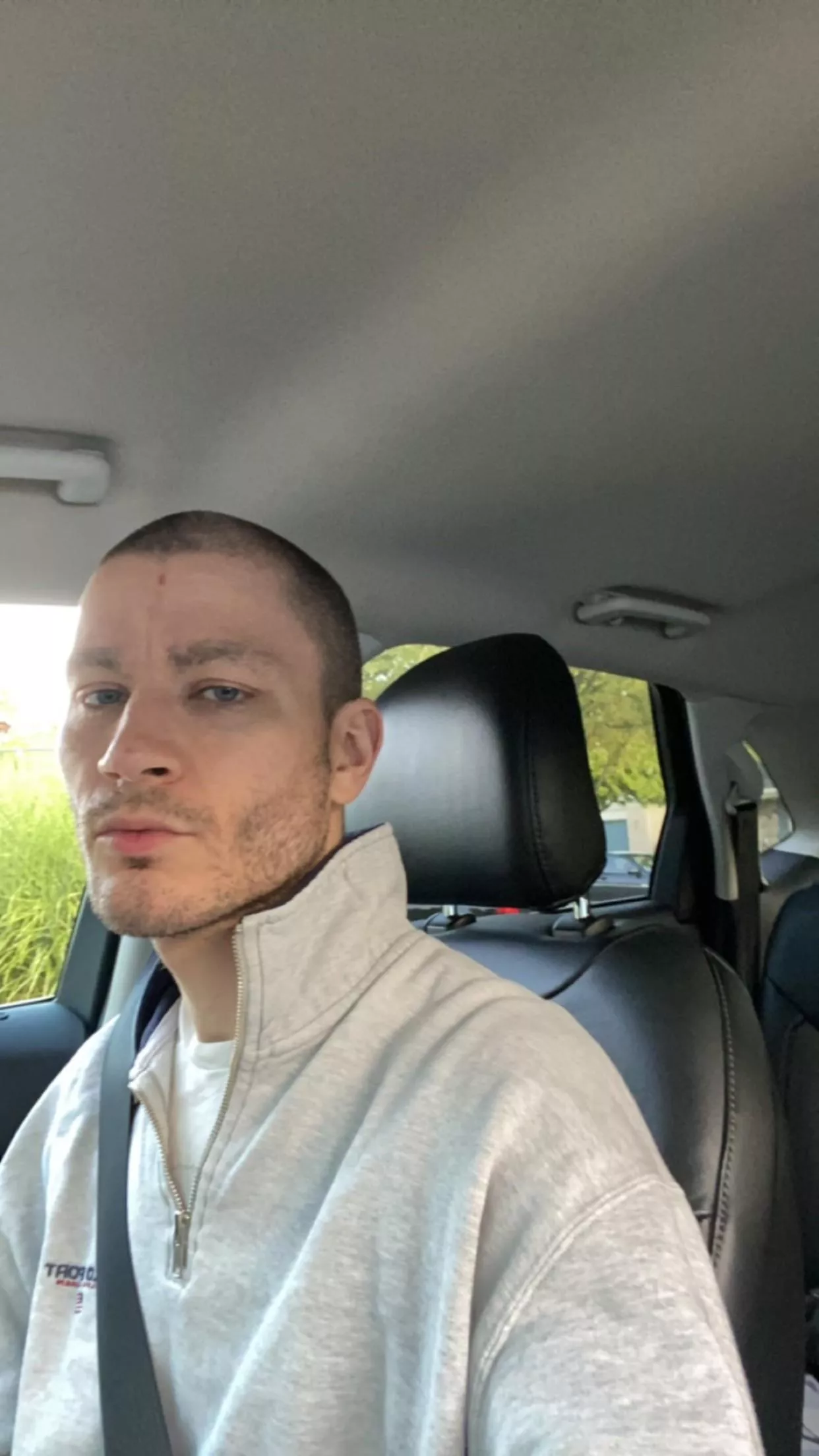 Guilty of a very modest duck lip. I think gaymers like ashnikko. Listening to weed killer in the 🚗