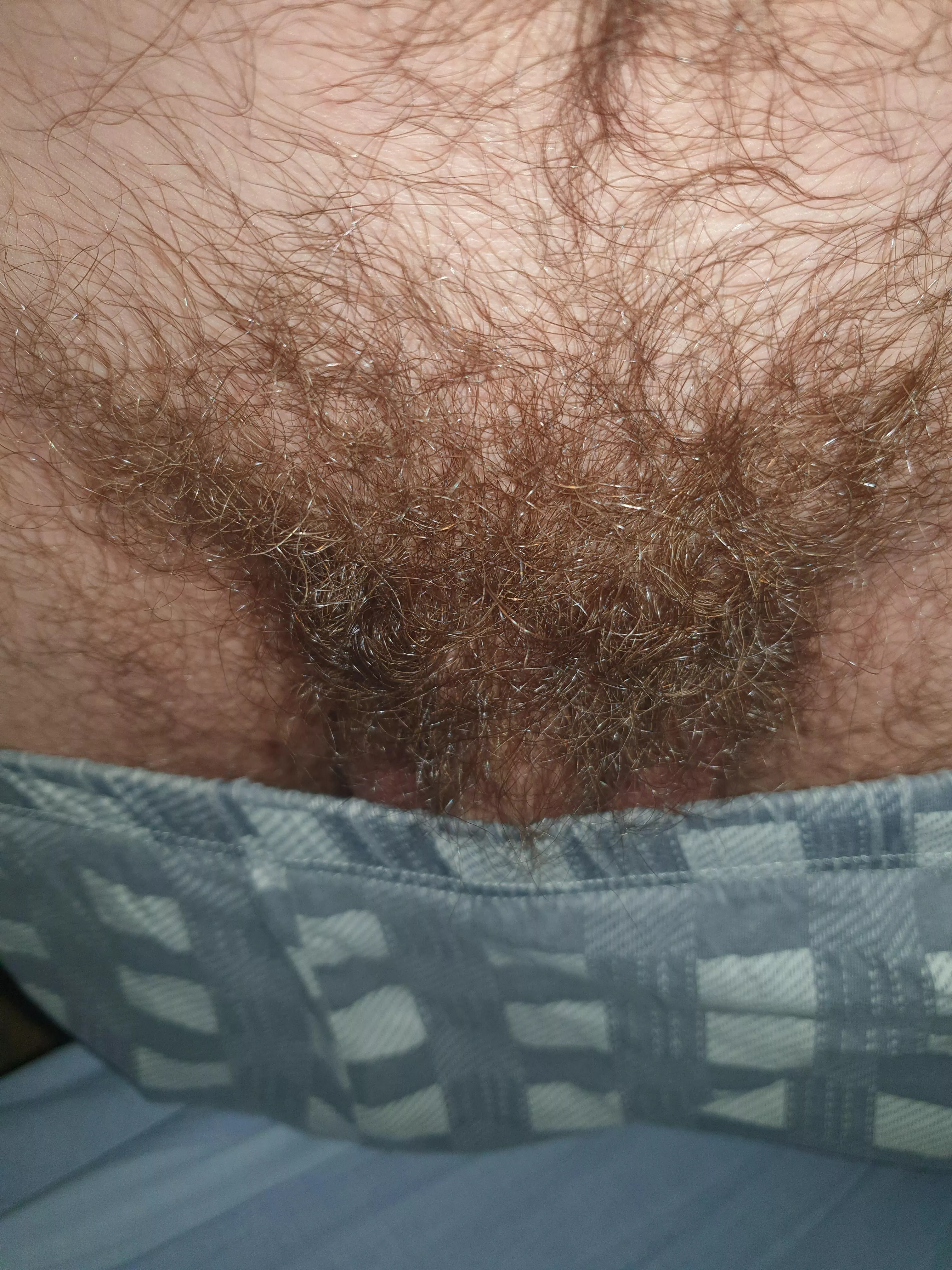 I think i need some treatment for my pubes