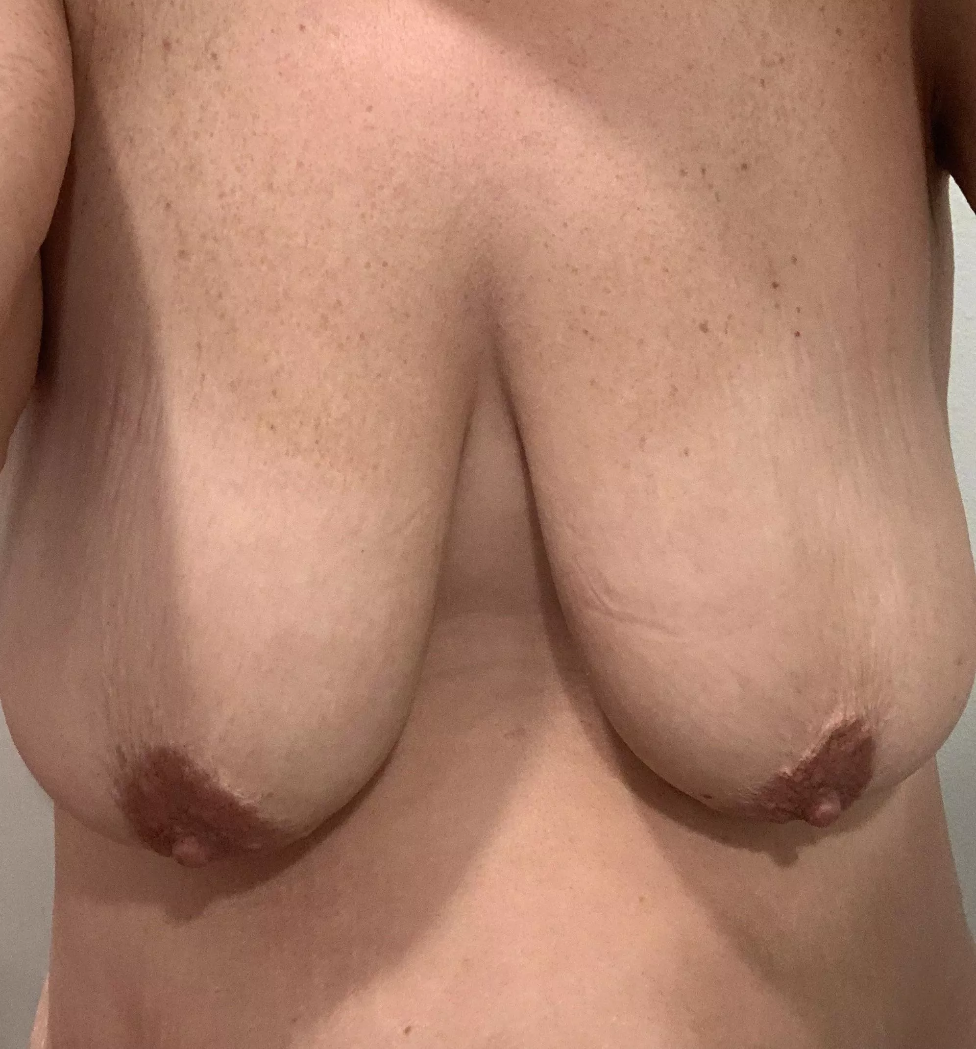 Hello from me and my saggy boobies