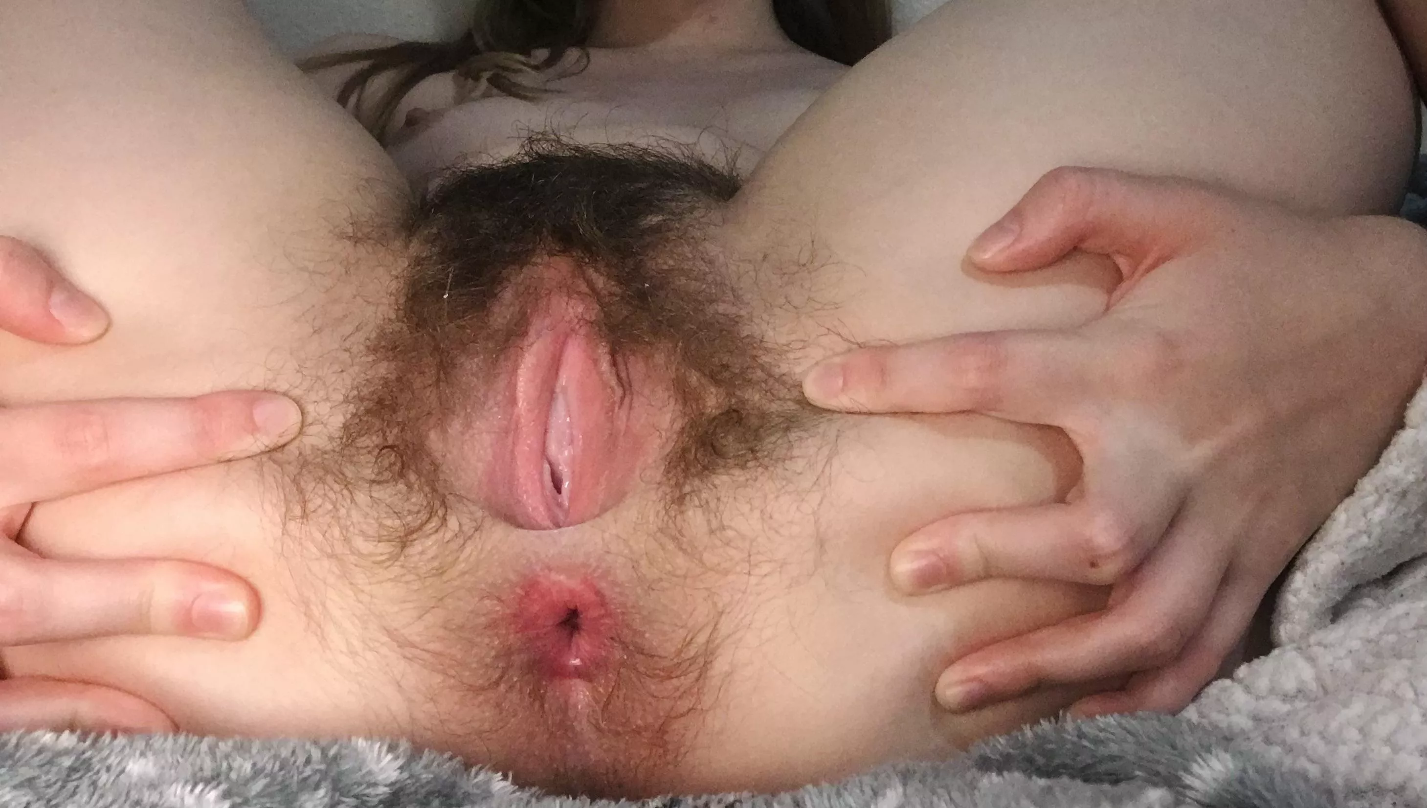 Am I too hairy?