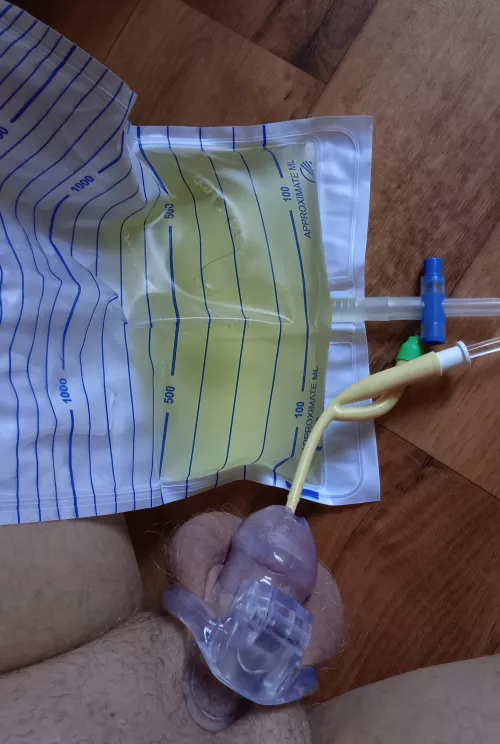 Chastity and catheter combo