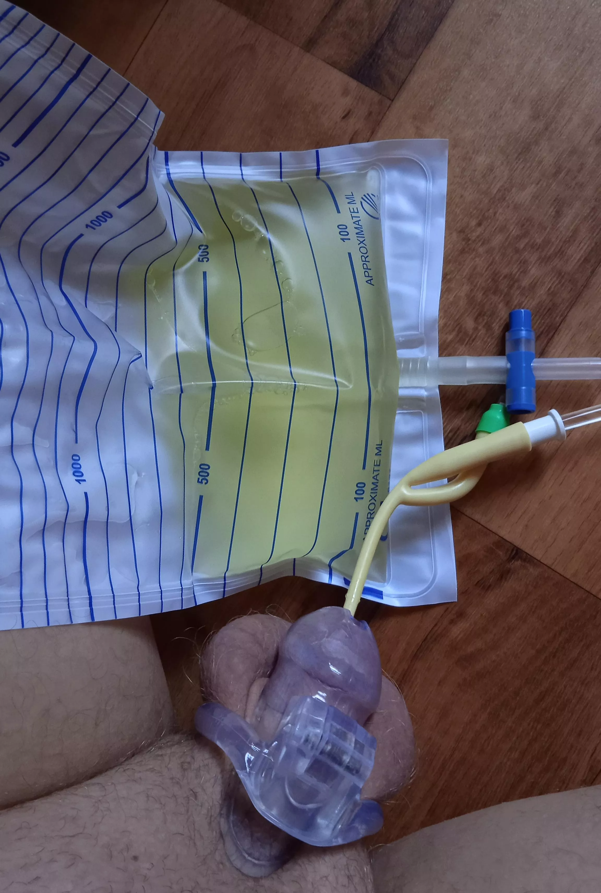 Chastity and catheter combo