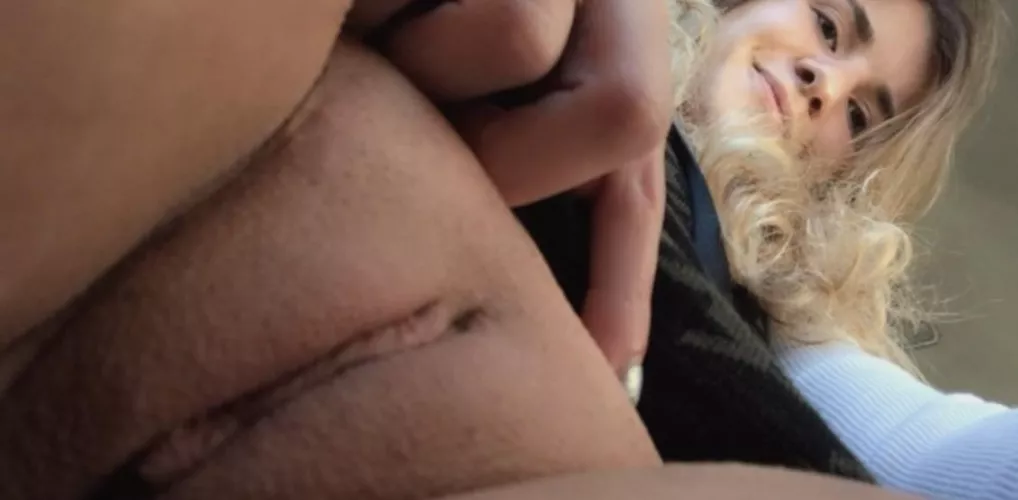 my mound is so puffy you can hardly see over it