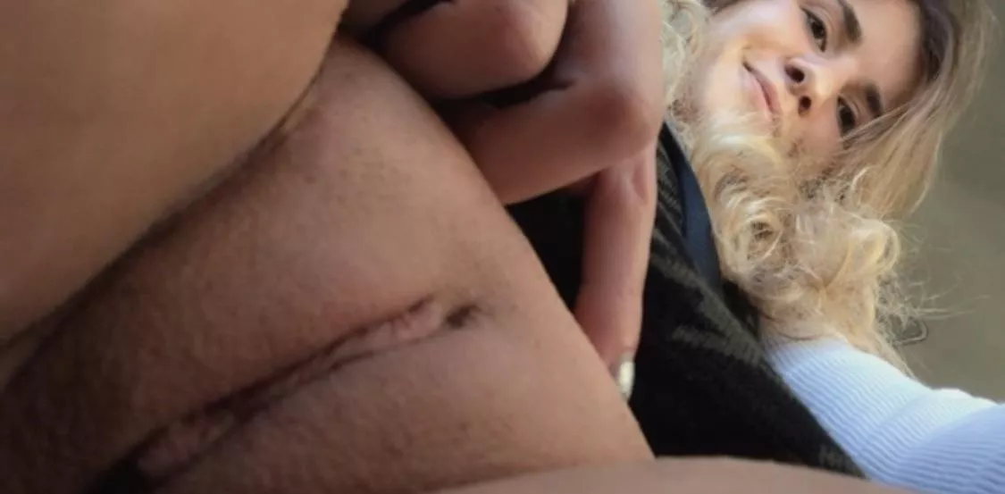 my mound is so puffy you can hardly see over it