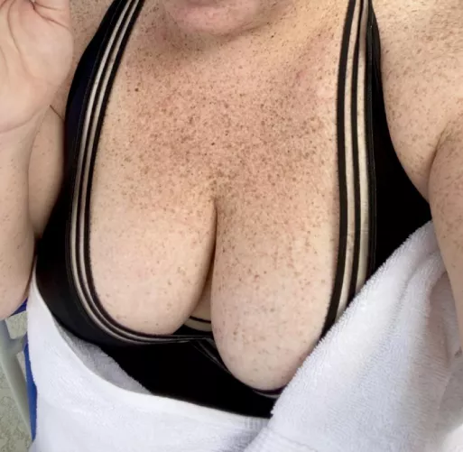 Whenever someone compliments my freckles, I know they mean these