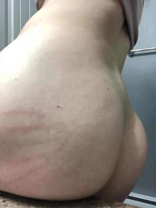 Still have my mark from last night