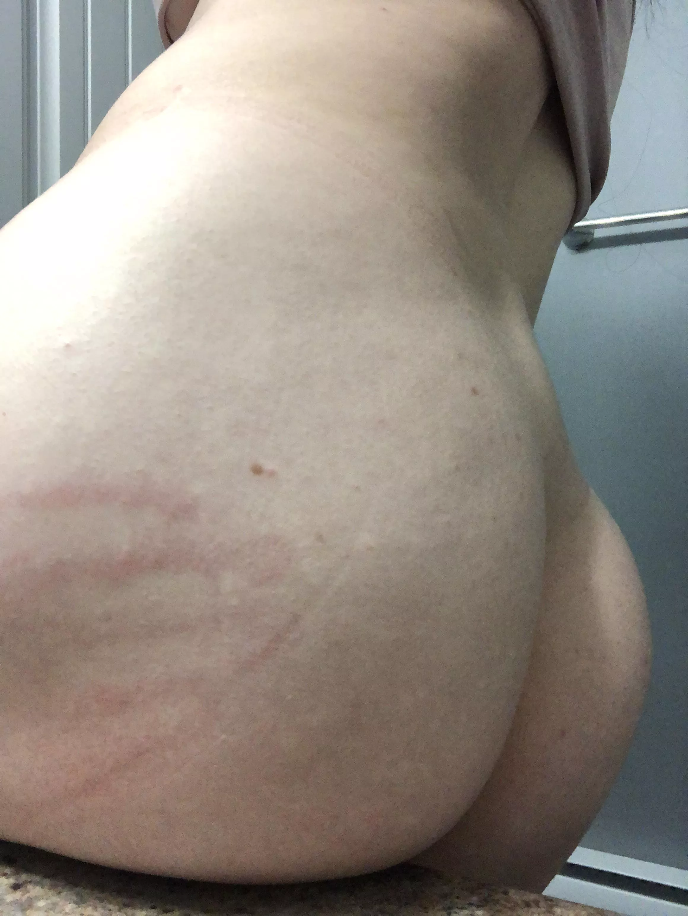 Still have my mark from last night