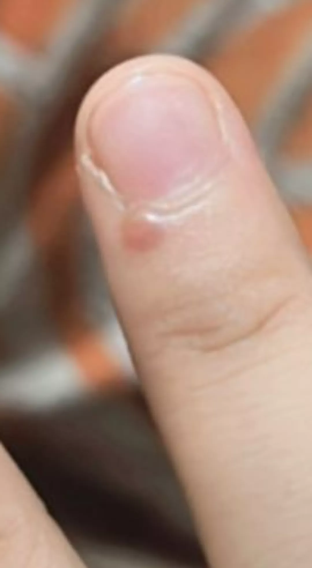 what's this small bump? it aches