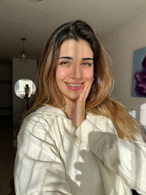 IUTR braces, freckles and dyed hair