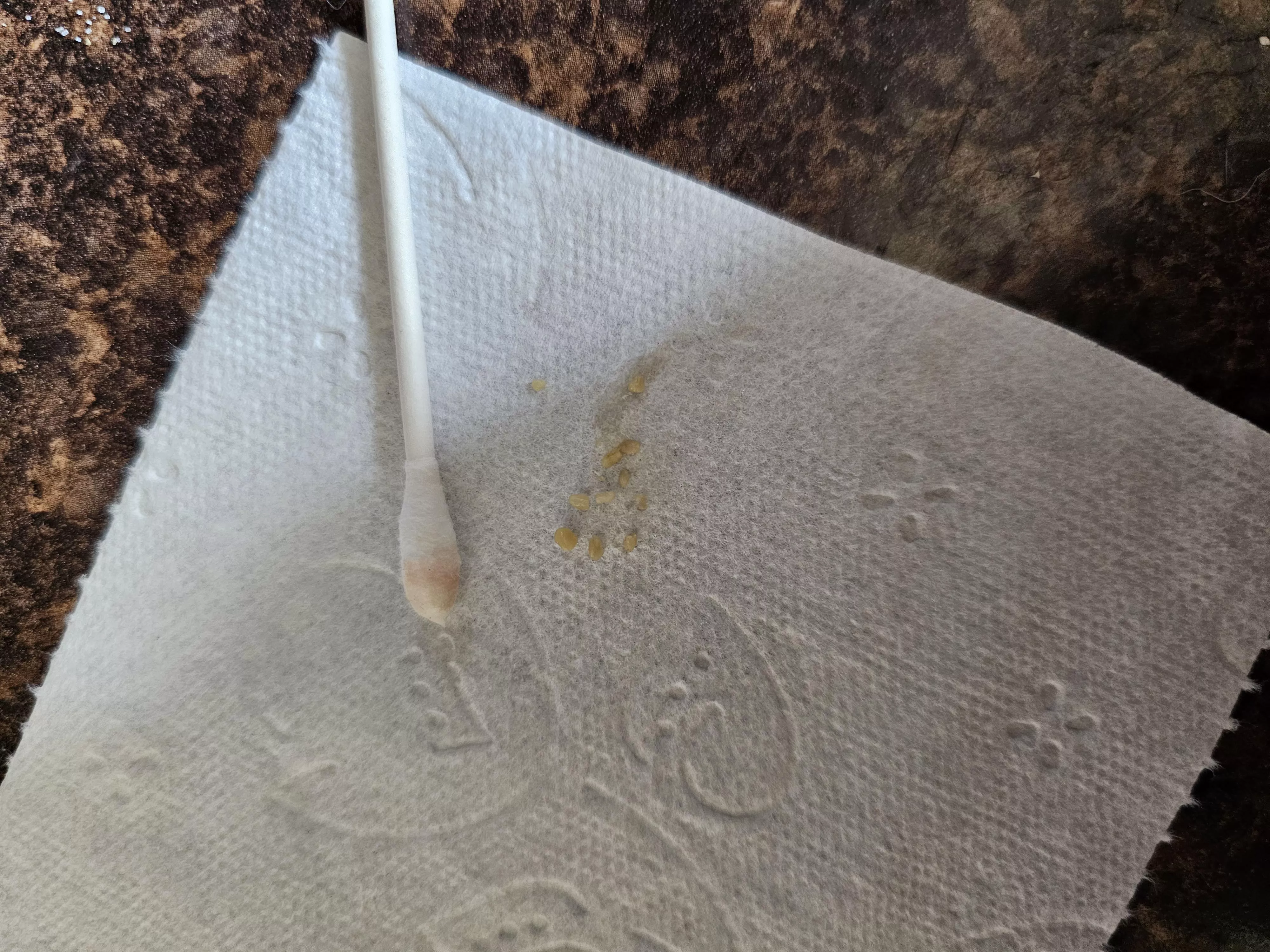 Tonsil stone haul after only 1 day