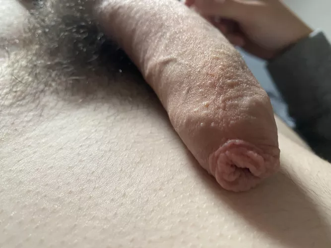 close up foreskin 😚