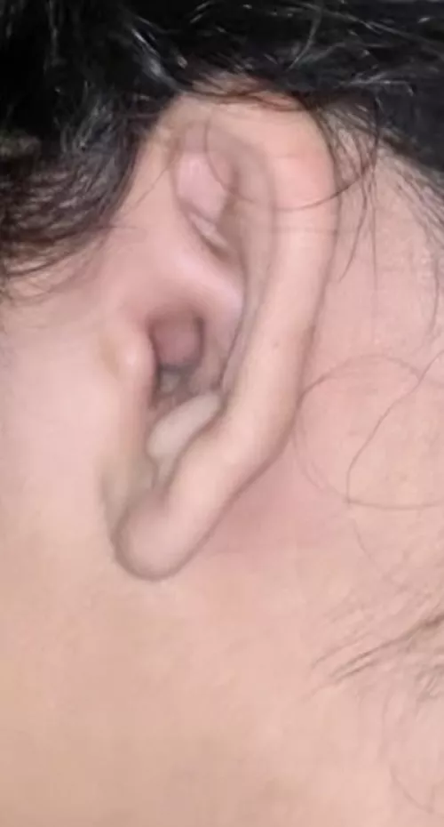 going to the doc tomorrow