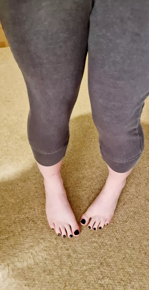 Are my black toes too dark with pale skin?