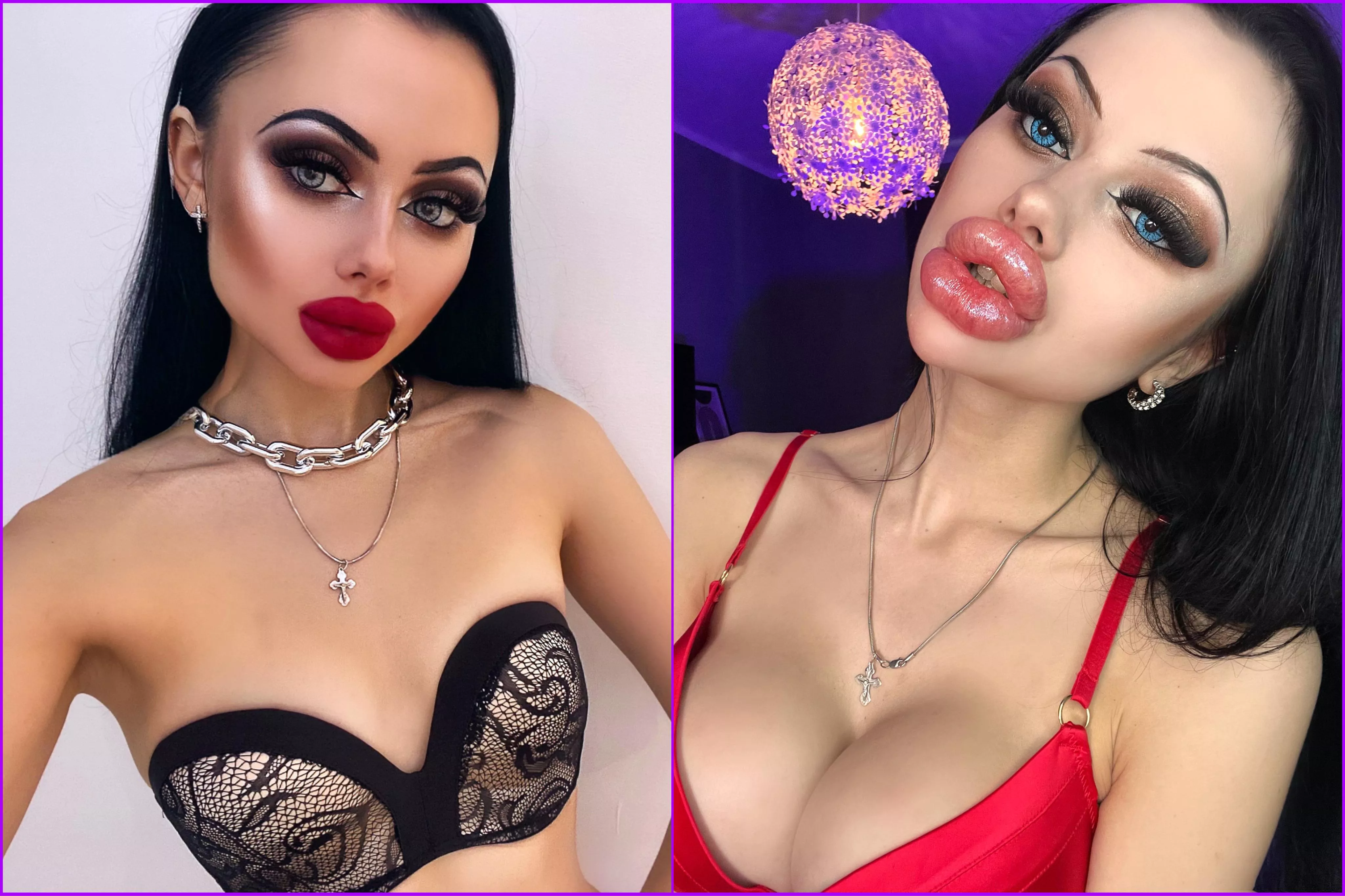 It took only one year to make breast implants, lips and chin Proud of myself