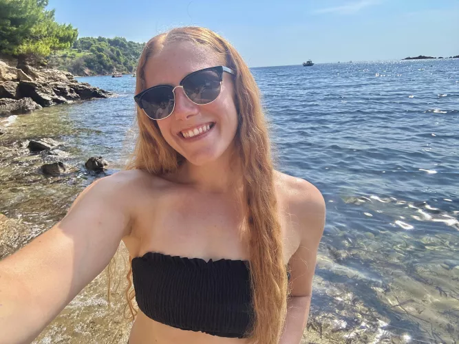 would you kiss my freckles one by one?