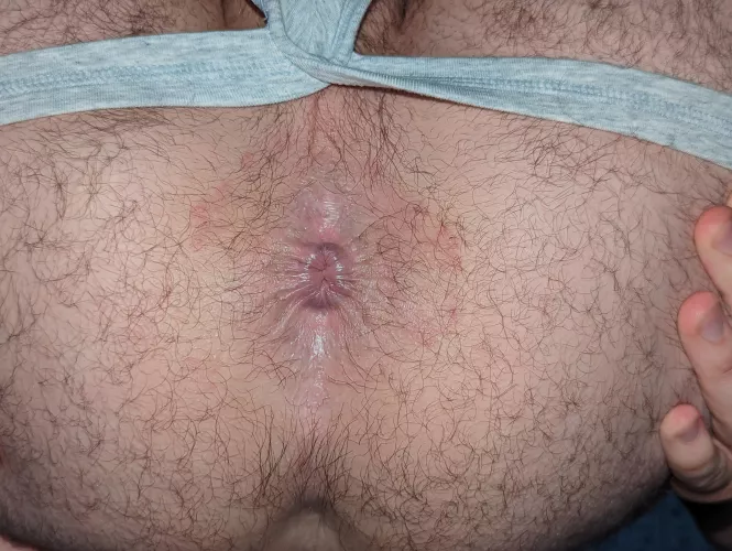 What are you going to do with my hole?