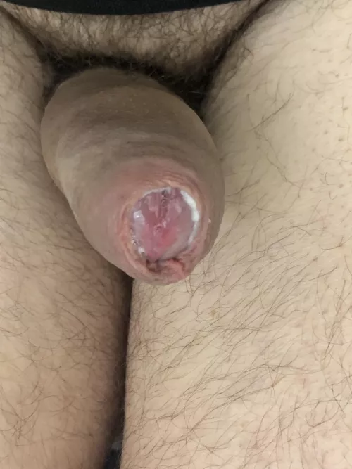 Oozing precum