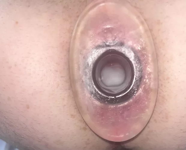 (34) more loads needed