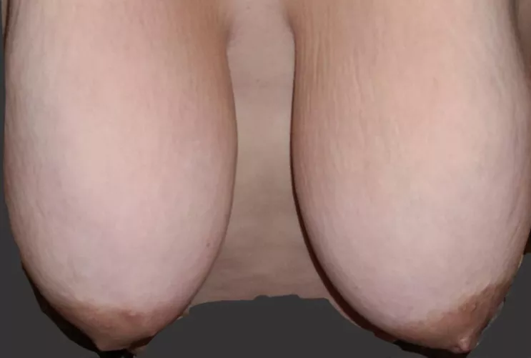 Bent over. Sorry for terrible 