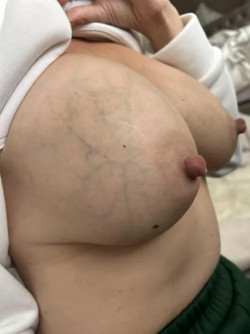 The engorgement is so real today.