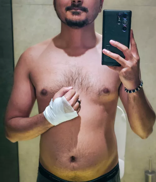 A speeding cyclist rode straight into me and knocked me out. Would you tend to my wounds, and my needs?