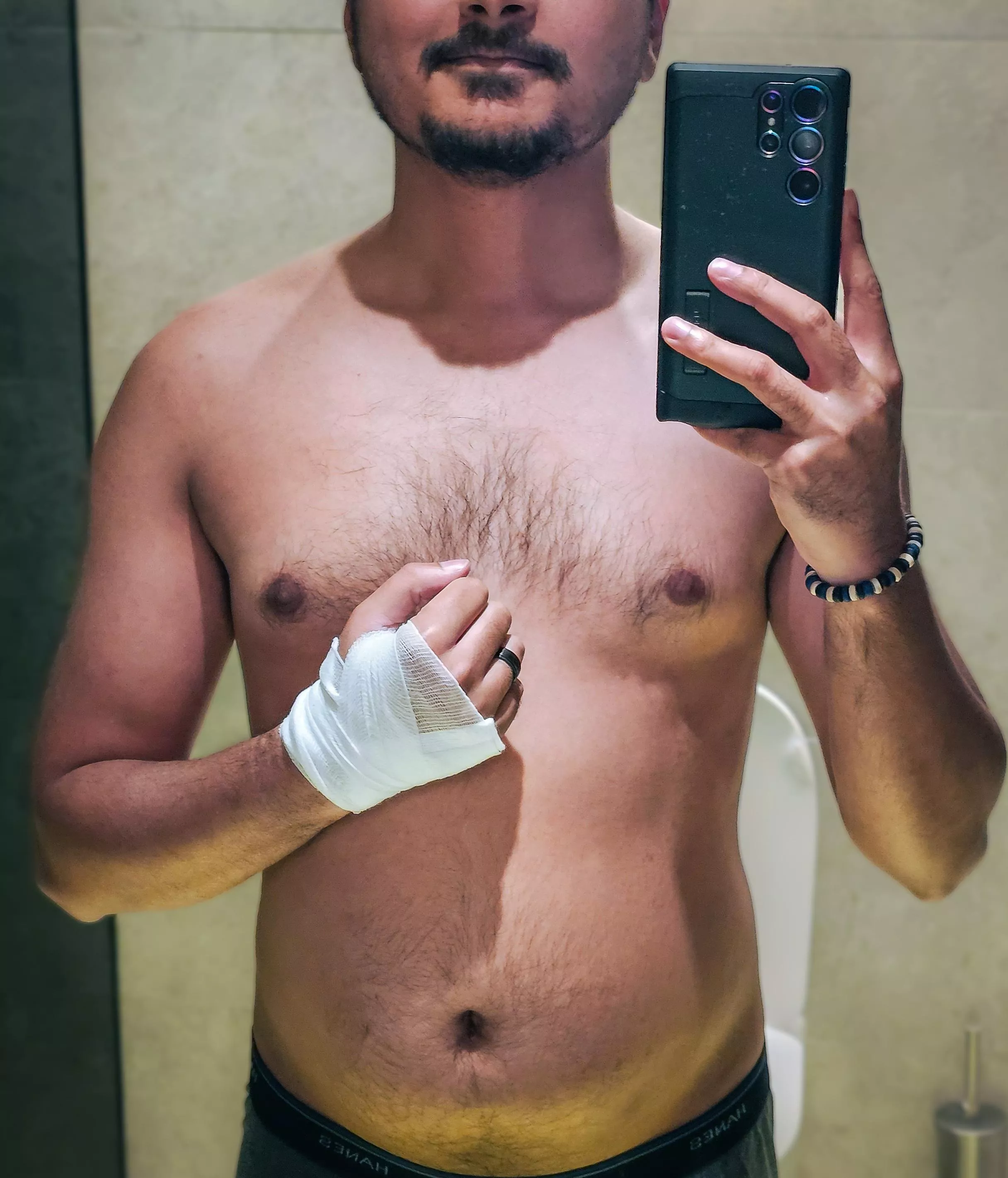 A speeding cyclist rode straight into me and knocked me out. Would you tend to my wounds, and my needs?