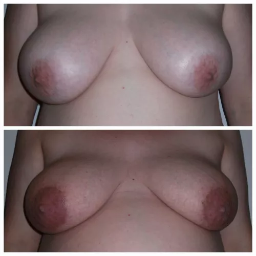 Friend pre-pregnancy to end of pregnancy. They definitely got engorged and veiny. Hope you enjoy.