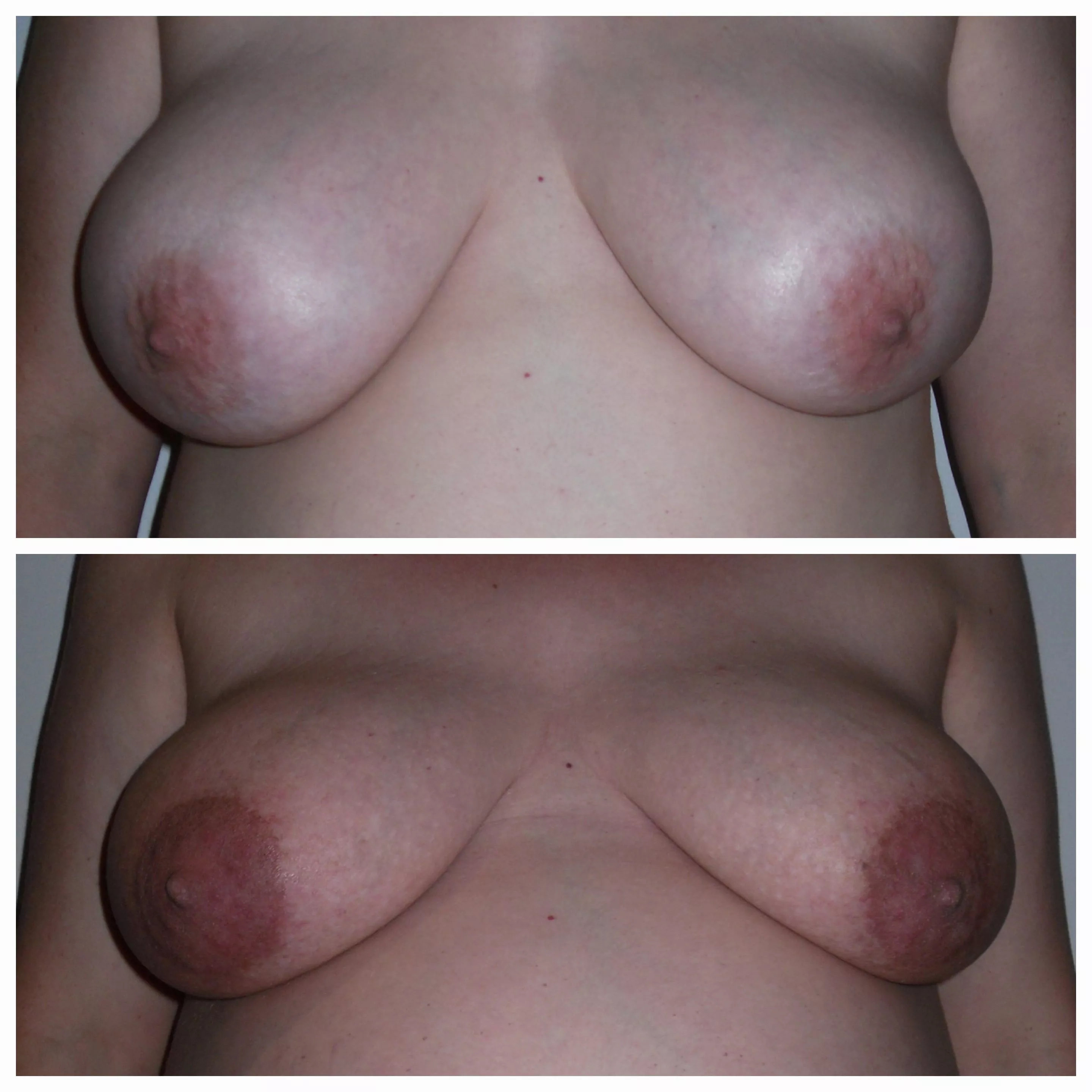 Friend pre-pregnancy to end of pregnancy. They definitely got engorged and veiny. Hope you enjoy.