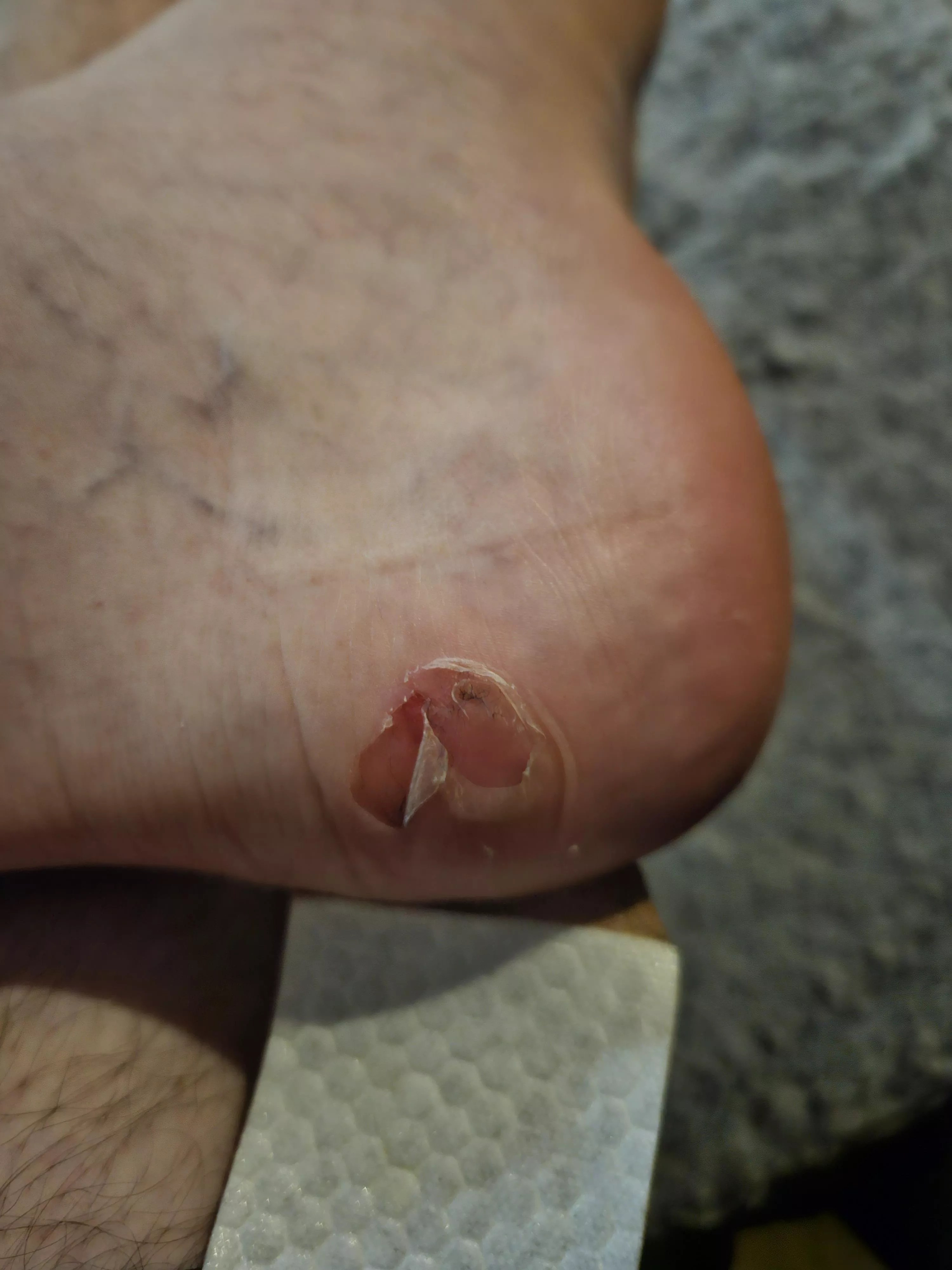 I did the thing I wasn't supposed to in my new IR