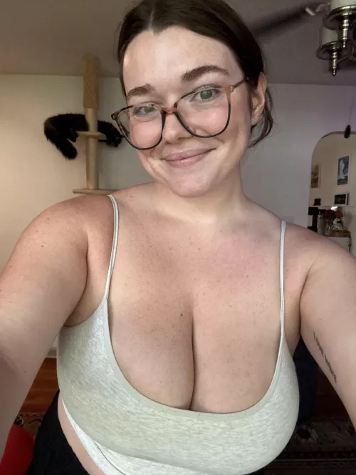 I’m covered in freckles