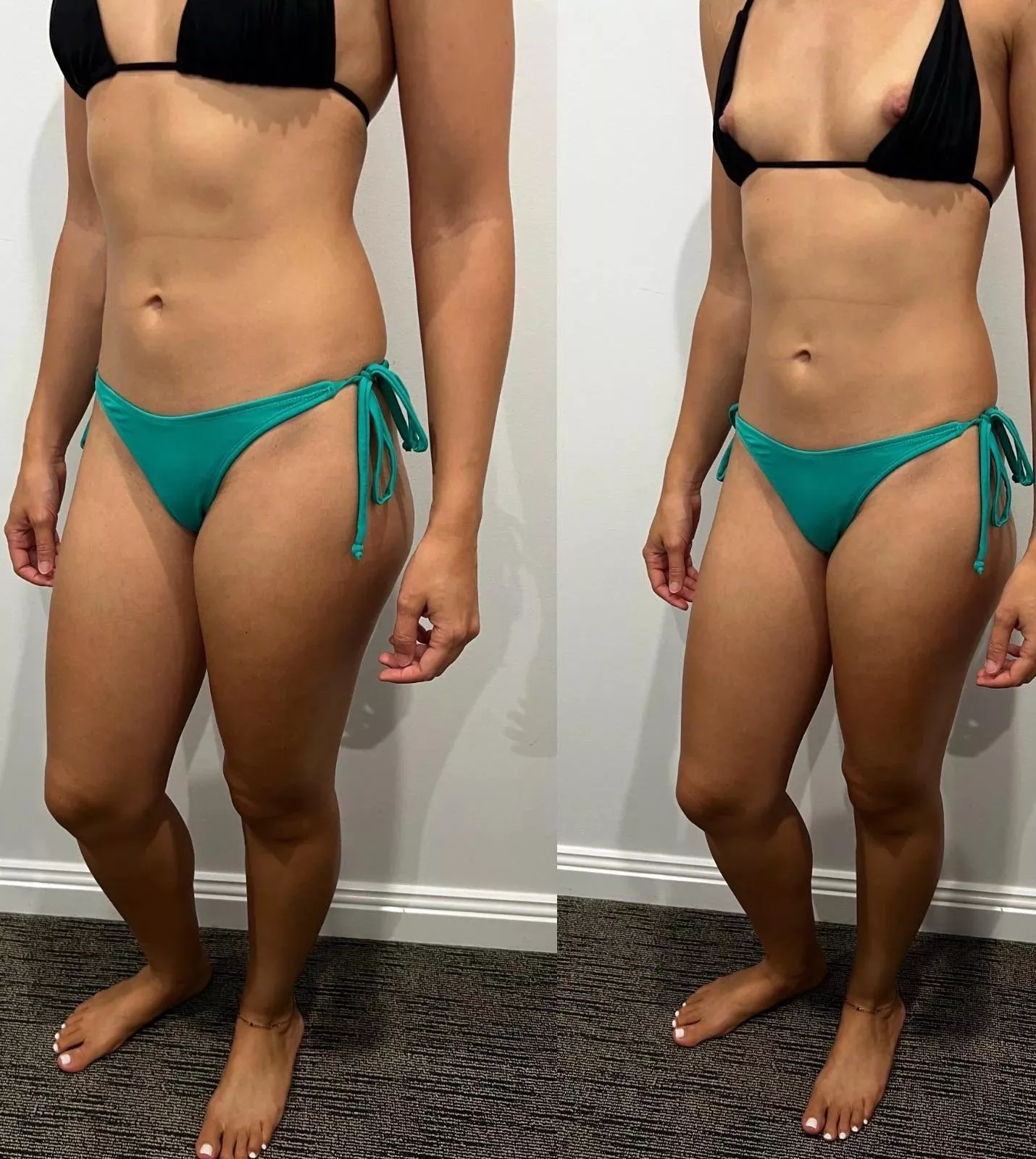 Total breeding material