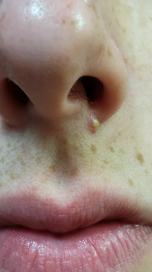 I have school and work tomorrow, would this be better or worse to pop it