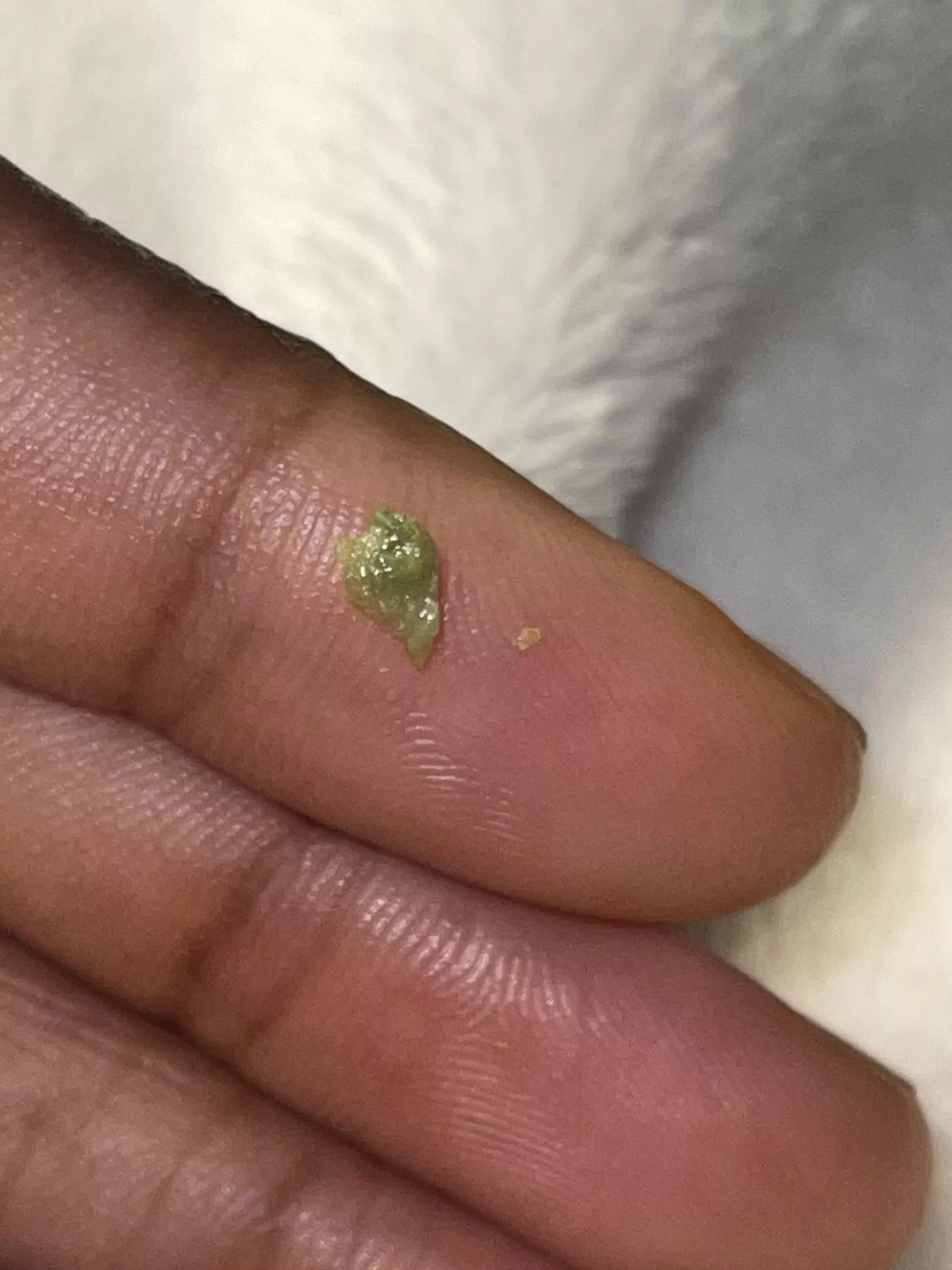 I coughed this up this morning. Haven’t ate anything green. It may be a tonsil stone.