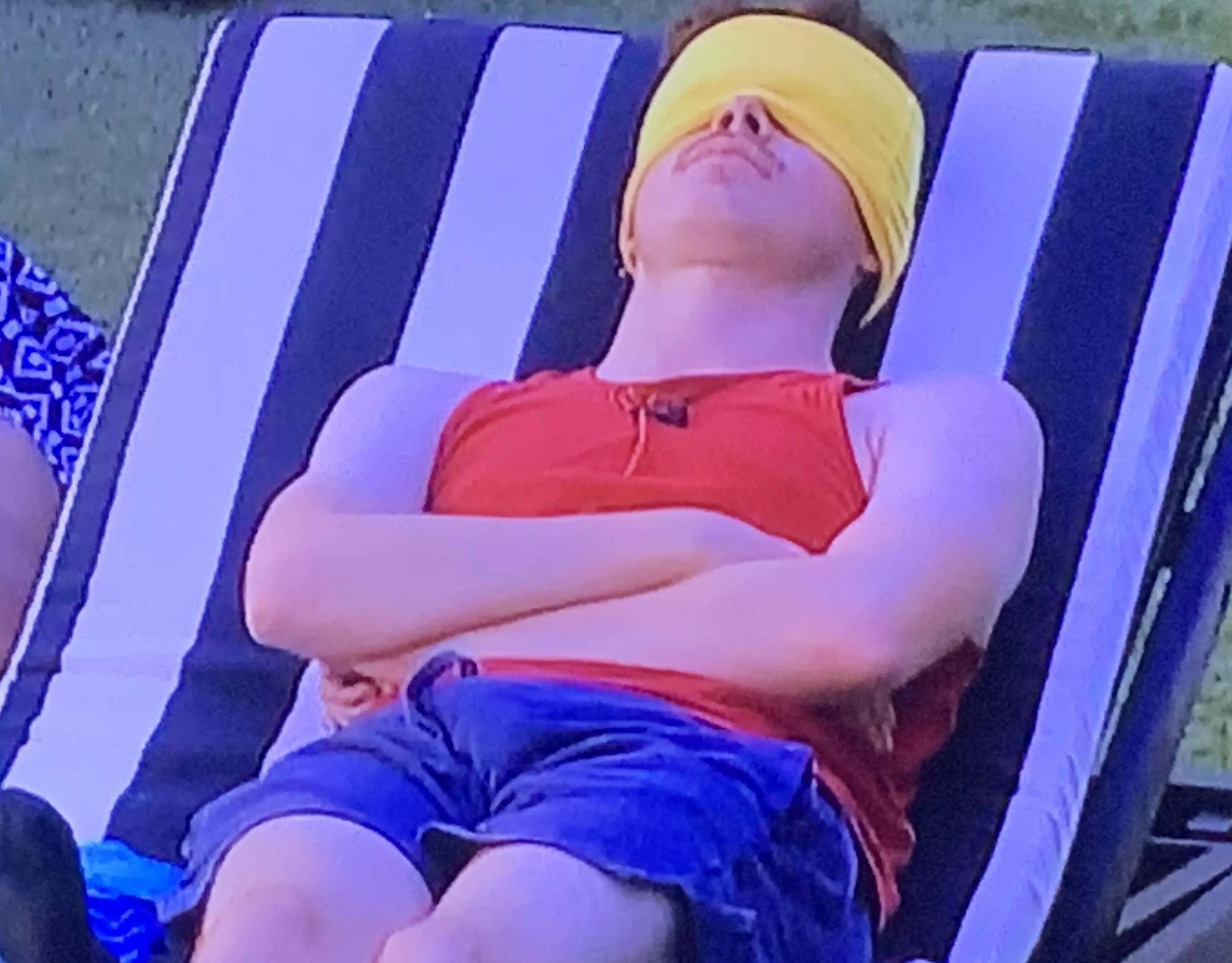 Corey bulging