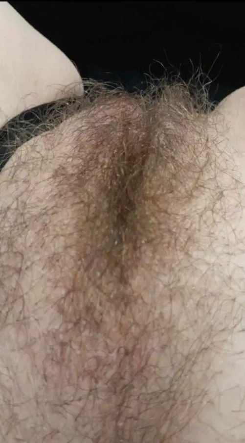 He said I should shave it should I?